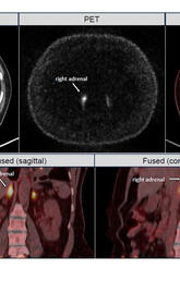 Medical scans